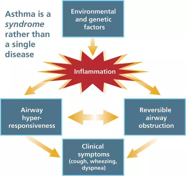 Infographic showing how severe Asthma entails symptoms that don