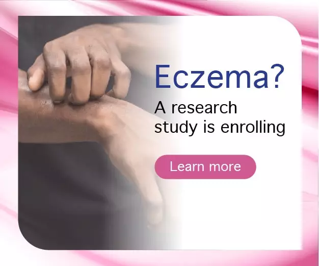 Photo of Eczema study image