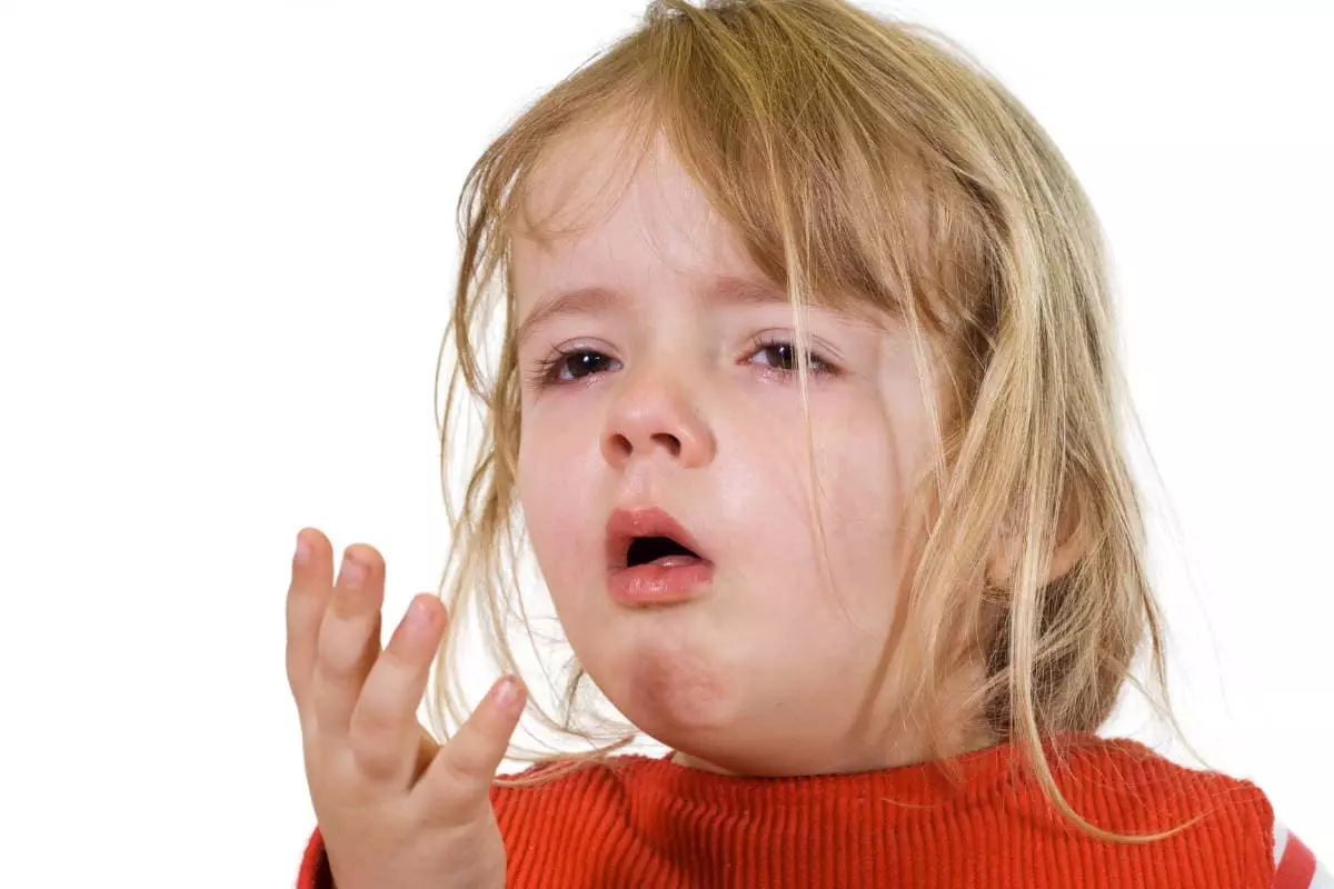 Young girl coughing so much from pertussis, whooping cough. She