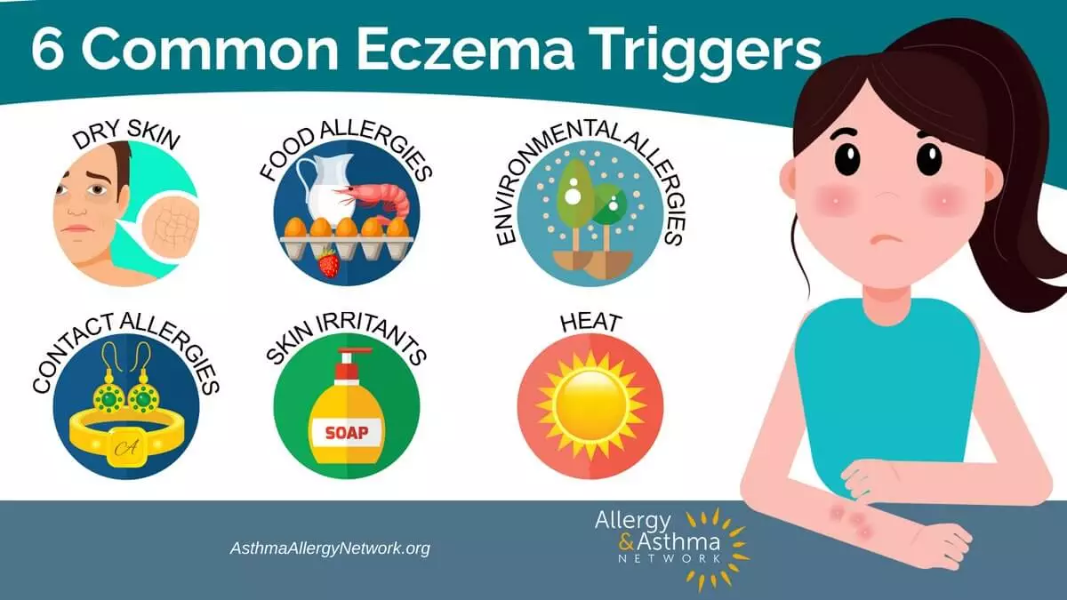 Infographic of 6 common eczema triggers: Dry skin, Food allergies, Contact allergies, Skin irritants, Environmental allergies, Heat