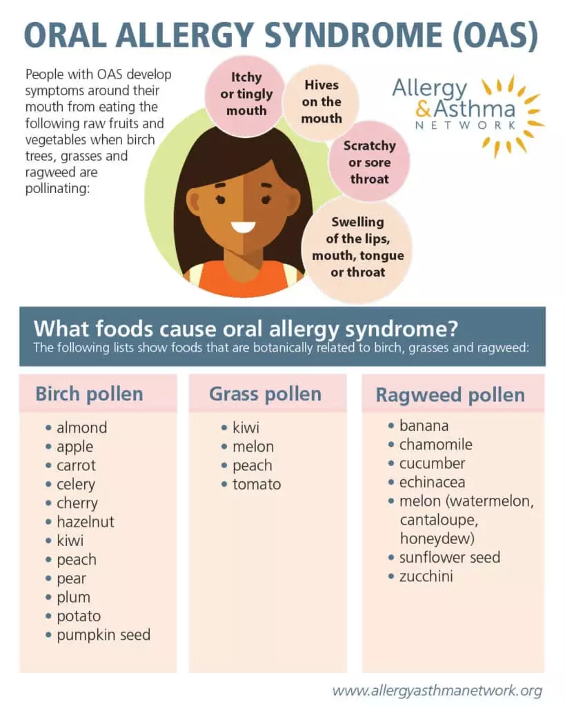 Infographic of Oral Allergy Syndrome Chart