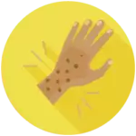 Icon of person's hand with eczema