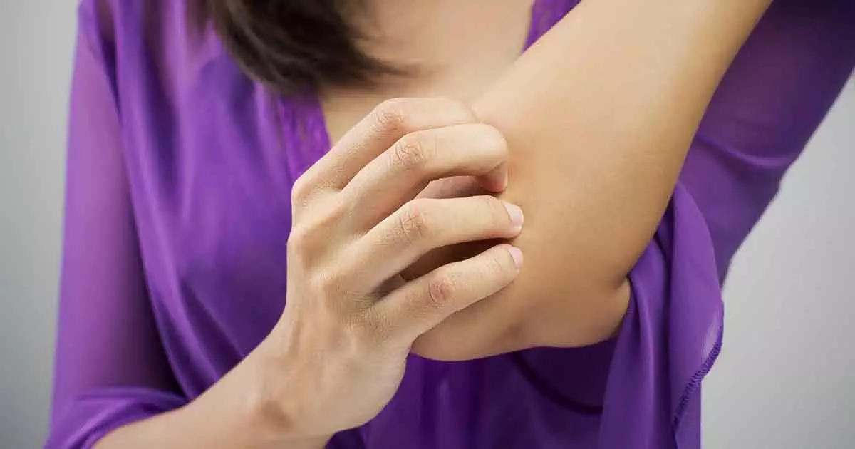 Photo of Woman scratching her arm