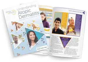 Image of Atopic Dermatitis PDF as a magazine layout mockup