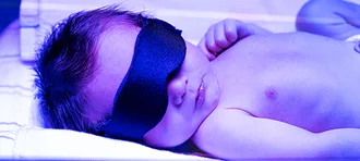 Photo of infant receiving phototherapy