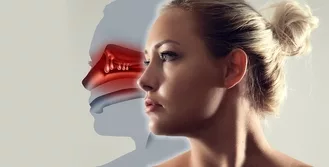 photo illustration of nasal polyps