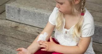 Young girl sitting on patio steps. She is wearing a white top and braids and has a unhappy facial expression. She is rubbing anti-itch cream on her arm.
