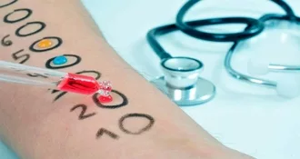 A person's arm marked with numbers and circles. There is a technician putting drops in the circles to give an allergy test to see what they are allergy to. There is a stethoscope in the background.