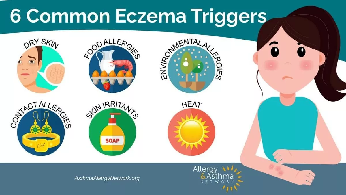Eczema Triggers